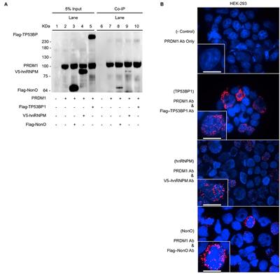 <mark class="highlighted">NonO</mark> Is a Novel Co-factor of PRDM1 and Regulates Inflammatory Response in Monocyte Derived-Dendritic Cells